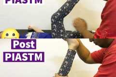 Hamstring Release  With PIASTM protocol