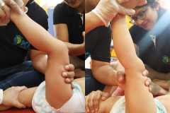 Hamstring Release  With PIASTM protocol