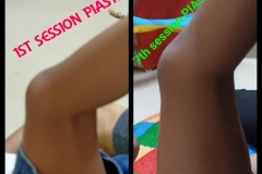 Hamstring Release  With PIASTM protocol